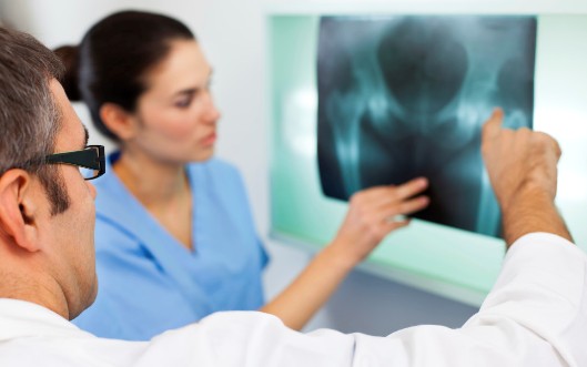 hip-replacement