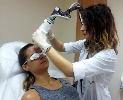 laser treatment