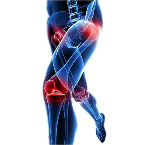 joint replacement in cyprus private health